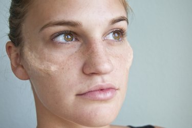 a woman waiting for cheekbone prosthetics to dry