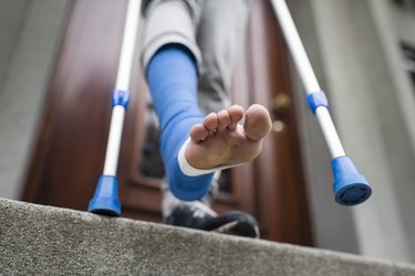Young adult walking with plaster bandage on foot